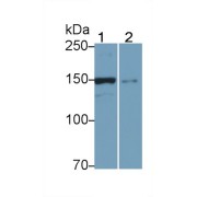 Western blot analysis of (1) Mouse Liver lysate, and (2) HeLa cell lysate, using Rabbit Anti-Mouse UTRN Antibody (0.2 µg/ml) and HRP-conjugated Goat Anti-Rabbit antibody (<a href="https://www.abbexa.com/index.php?route=product/search&amp;search=abx400043" target="_blank">abx400043</a>, 0.2 µg/ml).