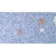 IHC-P analysis of Human Pancreas Tissue, with DAB staining, using Mouse Anti-Human CAMP Antibody (30 µg/ml) and HRP-conjugated Goat Anti-Mouse antibody (<a href="https://www.abbexa.com/index.php?route=product/search&amp;search=abx400001" target="_blank">abx400001</a>, 2 µg/ml).