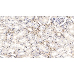 Gelsolin (GSN) Antibody