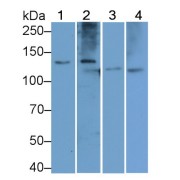 Western blot analysis of Human plasma (Lane 1), Mouse lung tissue (Lane 2), Mouse cerebrum tissue (Lane 3), A375 cell lysate (Lane 4), using Procollagen Type I C-Terminal Propeptide Antibody (1 µg/ml) and HRP-conjugated Goat Anti-Rabbit antibody (<a href="https://www.abbexa.com/index.php?route=product/search&amp;search=abx400043" target="_blank">abx400043</a>, 0.2 µg/ml).