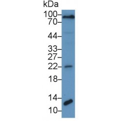 Procollagen Type III N-Terminal Propeptide (PIIINP) Antibody