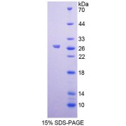 SDS-PAGE analysis of Human GCNF Protein.