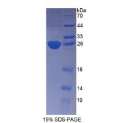 SDS-PAGE analysis of Mouse KATNA1 Protein.