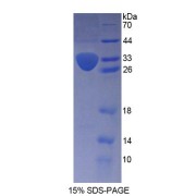 SDS-PAGE analysis of Human KTN1 Protein.