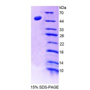 SDS-PAGE analysis of recombinant Human LAD1 Protein.