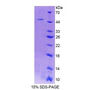 SDS-PAGE analysis of Rat LAD1 Protein.