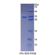 SDS-PAGE analysis of Human LDOC1 Protein.