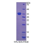 SDS-PAGE analysis of Mouse XYLT2 Protein.