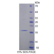 SDS-PAGE analysis of Rat MARCO Protein.