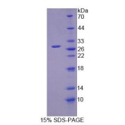 SDS-PAGE analysis of Mouse OPHN1 Protein.