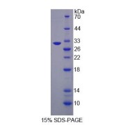 SDS-PAGE analysis of Mouse OS9 Protein.