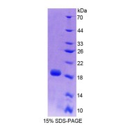 SDS-PAGE analysis of Mouse PLTP Protein.