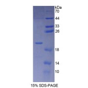 SDS-PAGE analysis of recombinant Human POMP Protein.