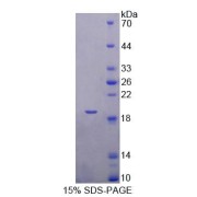 SDS-PAGE analysis of Mouse TBCA Protein.