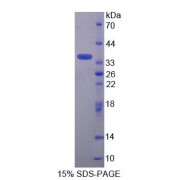 SDS-PAGE analysis of Mouse TNRC6A Protein.