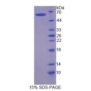 SDS-PAGE analysis of Human SCRN1 Protein.