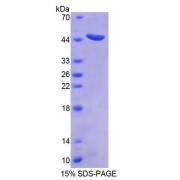 SDS-PAGE analysis of Human STAM2 Protein.