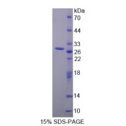 SDS-PAGE analysis of recombinant Human STIM1 Protein.