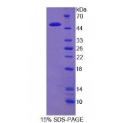 SDS-PAGE analysis of Human RTN1 Protein.