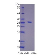 SDS-PAGE analysis of Human FGF20 Protein.