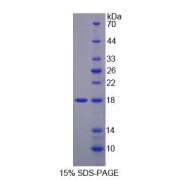 SDS-PAGE analysis of Mouse MARS Protein.