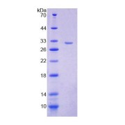 SDS-PAGE analysis of Mouse VARS Protein.