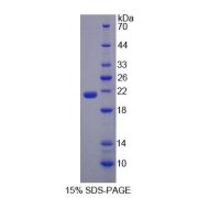 SDS-PAGE analysis of Rat LCN11 Protein.