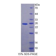 SDS-PAGE analysis of Human LRP2 Protein.