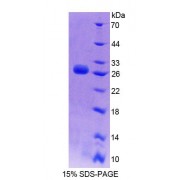 SDS-PAGE analysis of Human SDF2L1 Protein.