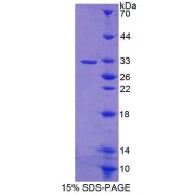 SDS-PAGE analysis of Mouse ABCB9 Protein.