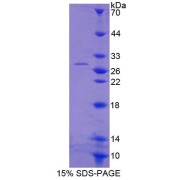 SDS-PAGE analysis of Human ACAA1 Protein.