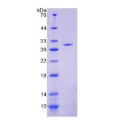 SDS-PAGE analysis of Human ACSM1 Protein.