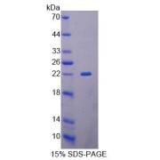 SDS-PAGE analysis of Human GCDH Protein.