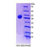 SDS-PAGE analysis of Rat PECI Protein.