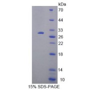 SDS-PAGE analysis of Human HMG20B Protein.