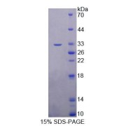 SDS-PAGE analysis of Human TOP3b Protein.