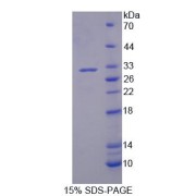 SDS-PAGE analysis of Rat PLA2G3 Protein.