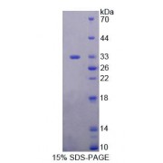 SDS-PAGE analysis of Human PLCh1 Protein.