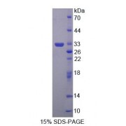 SDS-PAGE analysis of Human ABAT Protein.