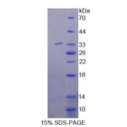 SDS-PAGE analysis of Mouse ABAT Protein.