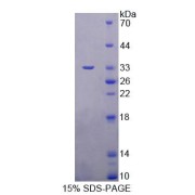 SDS-PAGE analysis of Human BCAT2 Protein.