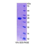 SDS-PAGE analysis of recombinant Rat BCAT2 Protein.