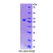 SDS-PAGE analysis of Mouse TCEA2 Protein.