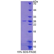 SDS-PAGE analysis of Rat GPX6 Protein.