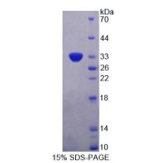 SDS-PAGE analysis of Human PLIN4 Protein.