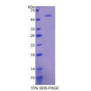 SDS-PAGE analysis of Human CTRB2 Protein.