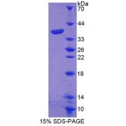 SDS-PAGE analysis of Human GLVR1 Protein.