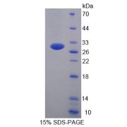 SDS-PAGE analysis of Human UBE2S Protein.