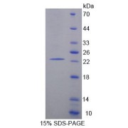 SDS-PAGE analysis of Human EIF2C1 Protein.