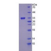 SDS-PAGE analysis of Human HSD17b3 Protein.